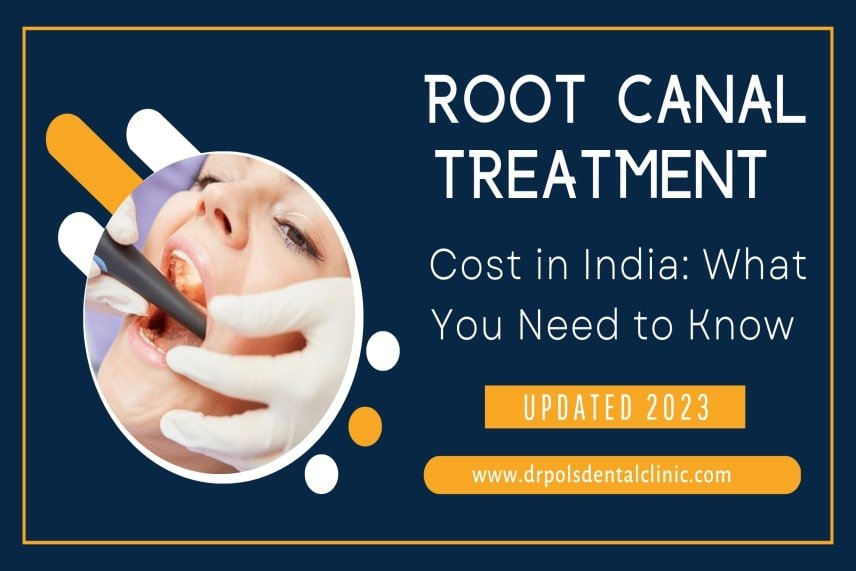 Root Canal Treatment Cost in India: What You Need to Know