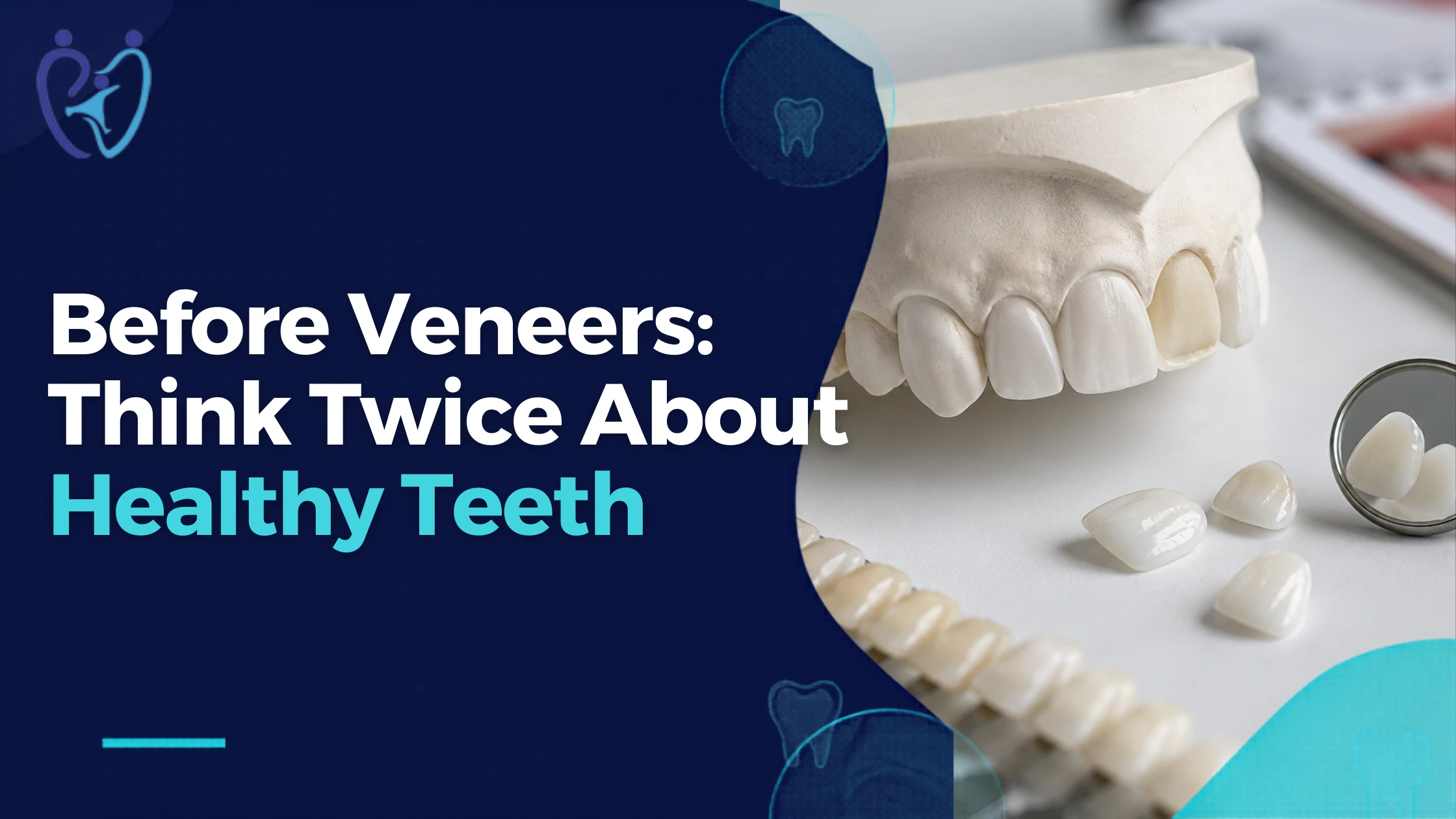 Before You Get Veneers: Why You Should Think Twice About Altering Healthy Teeth