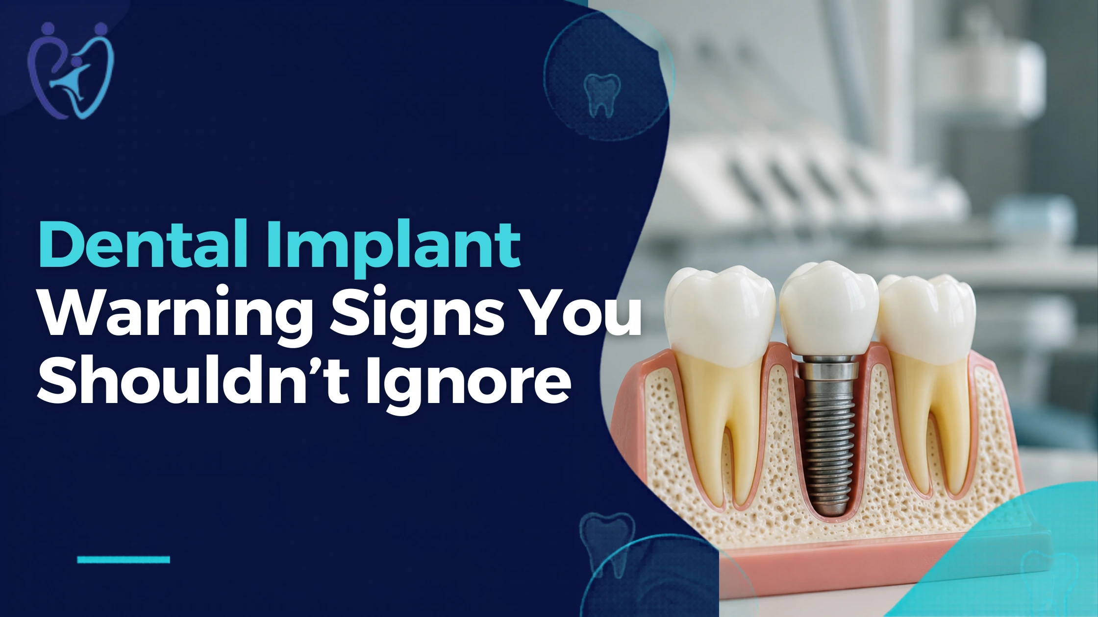 Is Something Wrong With Your Dental Implant? 6 Warning Signs You Shouldn’t Ignore